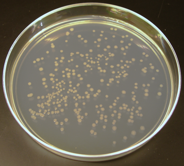 Mikrobiologia - Ecoli_colonies1.png